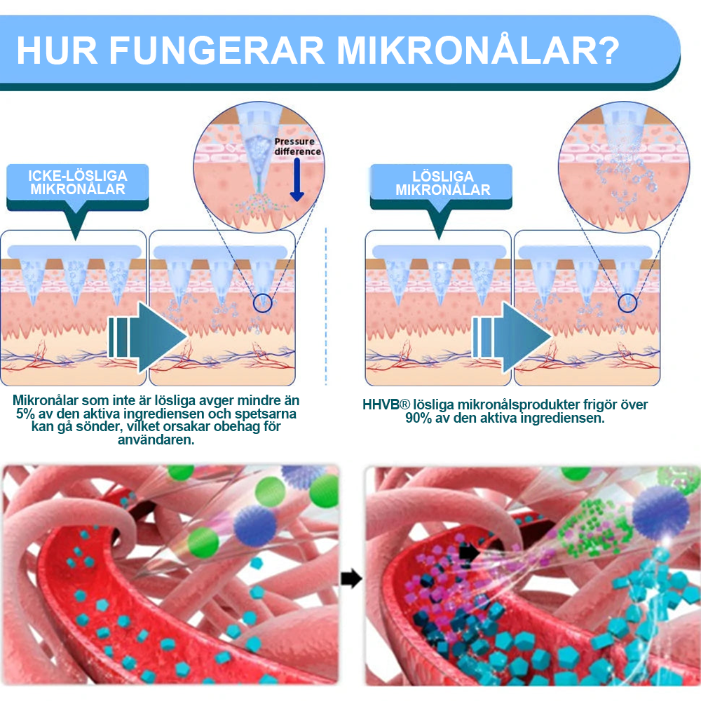 【Sista Dagens Kampanj 70 % Rabatt👩‍⚕️】𝐇𝐇𝐕𝐁® NIDDK-Tirzepatid Nano-mikronålsplåster👨‍⚕️（Noll Smärta, 24/7 Frisläppning | Gå Ner 20 Pund Snabbt | 90 % Sockerreduktion | ）