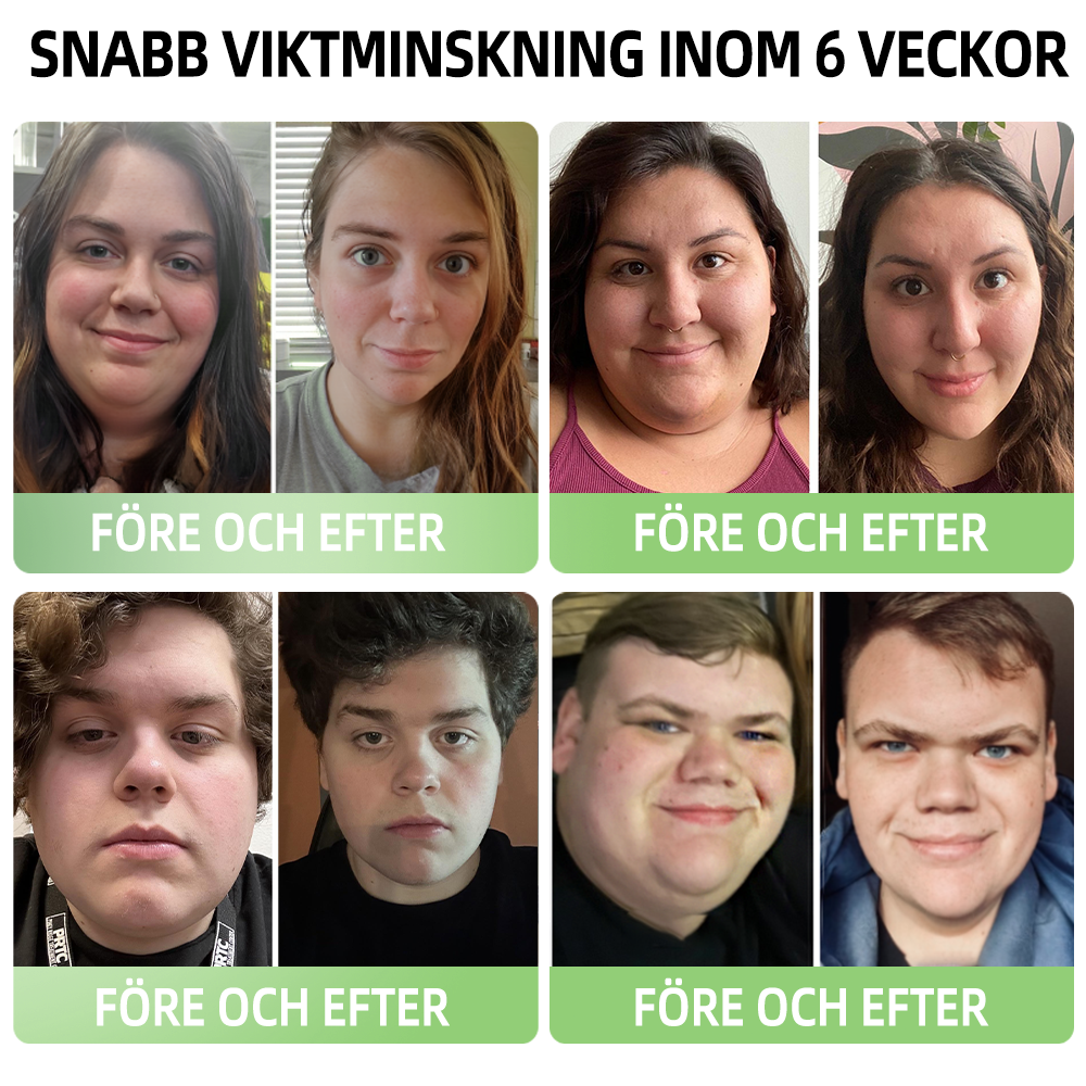 𝑷𝑬𝑨𝑹𝑳𝑴𝑶𝑶𝐍™ Formande shorts i is-silke med jonfibrer för återhämtning 👨‍⚕️Fettförbränning, huduppstramning, främjar cirkulation och lymfdränage för holistisk hälsa