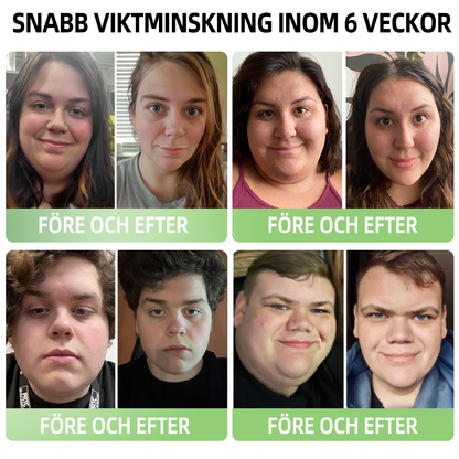 𝑷𝑬𝑨𝑹𝑳𝑴𝑶𝑶𝐍™ Formande shorts i is-silke med jonfibrer för återhämtning 👨‍⚕️Fettförbränning, huduppstramning, främjar cirkulation och lymfdränage för holistisk hälsa